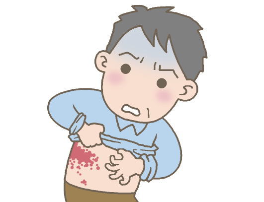 帯状疱疹の男性